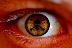 Moorfields Eye Hospital Develop New Glaucoma Test | Londonist