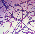 0301_anthrax.jpg