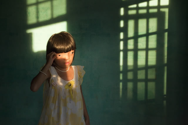 2nd Prize Contemporary Issues Single: Ed Kashi, USA, VII Photo Agency. Nguyen Thi Ly, 9, suffers from Agent Orange disabilities, Da Nang, Vietnam