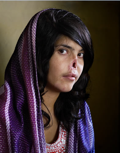 World Press Photo of the Year 2010: Jodi Bieber, South Africa, Institute for Artist Management/Goodman Gallery for Time magazine