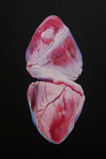 Heatraehill III, Geoffrey Harrison. Image courtesy of the artist and Barts Pathology Museum