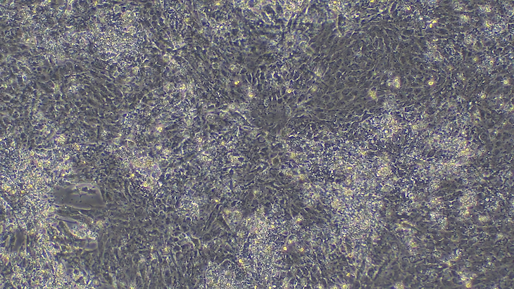 A close up of cardiac cells - a greyish textured image with few features
