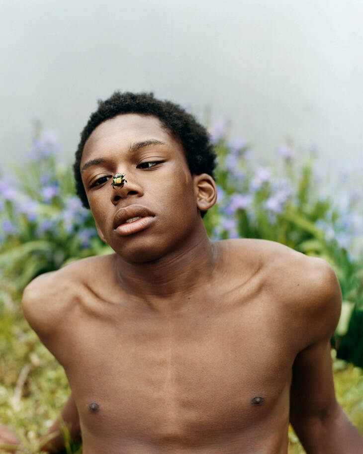 A young man studying a fly on his nose