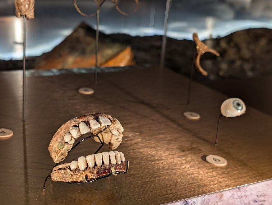 A pair of dentures and a prosthetic eye