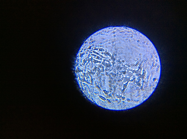 A microbe under a microscope